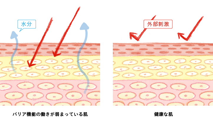 バリア機能の働きが弱まっている肌と健康な肌 バリア機能の働きが弱まっている肌と健康な肌